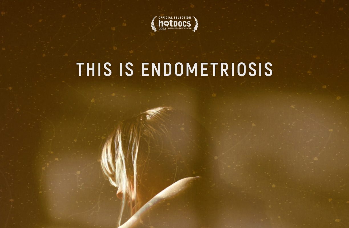 This is Endometriosis